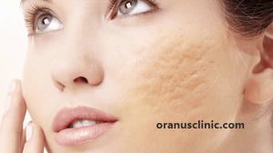 سابسیژن - کلینیک اورانوس