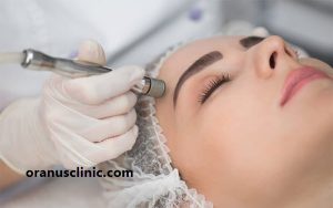 میکرودرم ابریژن - کلینیک اورانوس