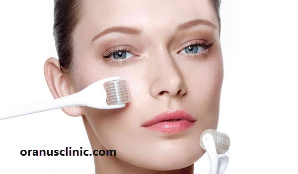 میکرونیدلینگ - کلینیک اورانوس