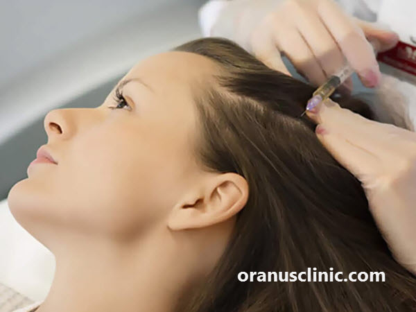 انجام هیر فیلر در غرب تهران - کلینیک اورانوس