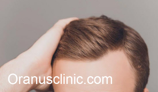 قیمت کاشت مو در کلینیک های غرب تهران - کلینیک اورانوس