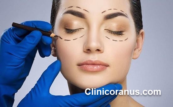 عمل بلفاروپلاستی چیست؟ | کلینیک اورانوس