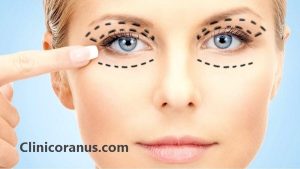 10 ویژگی برتر جراح بلفاروپلاستی - کلینیک اورانوس