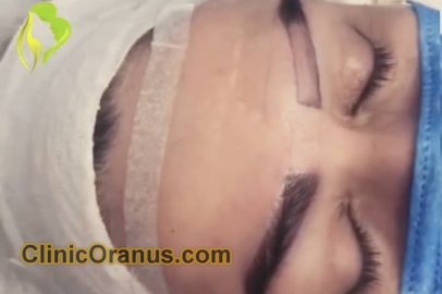 بهترین کلینیک زیبایی در جنت آباد | کلینیک اورانوس