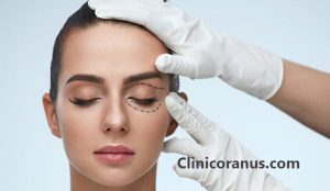 بهترین مرکز جراحی پلک در غرب تهران - کلینیک اورانوس