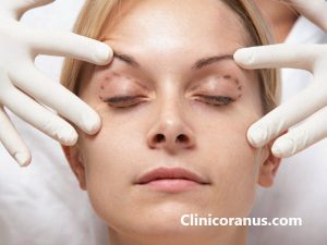 بهترین مرکز جراحی پلک در غرب تهران - کلینیک اورانوس