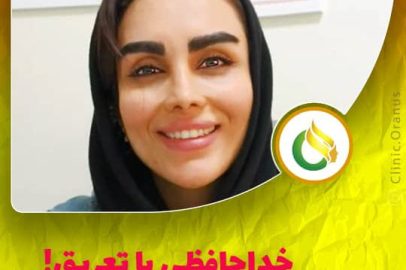 بوتاکس زیر بغل | کلینیک اورانوس