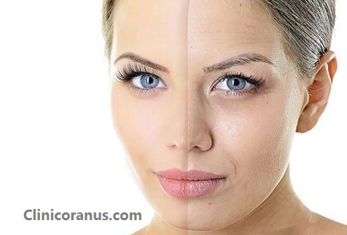 مرکز جوانسازی پوست در غرب تهران | کلینیک اورانوس