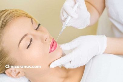 همه چیز درباره تزریق ژل لب | کلینیک اورانوس