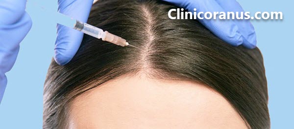 کاشت مو در بهترین کلینیک زیبایی جنت آباد - کلینیک اورانوس