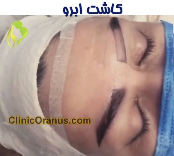 بهترین کلینیک زیبایی در جنت آباد | کلینیک اورانوس