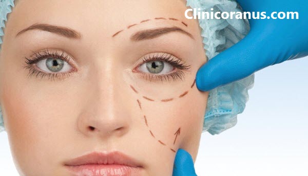 بهترین مرکز جراحی پلک در غرب تهران - کلینیک اورانوس