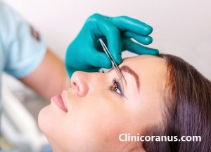 بهترین دکتر عمل پلک در تهران - کلینیک اورانوس