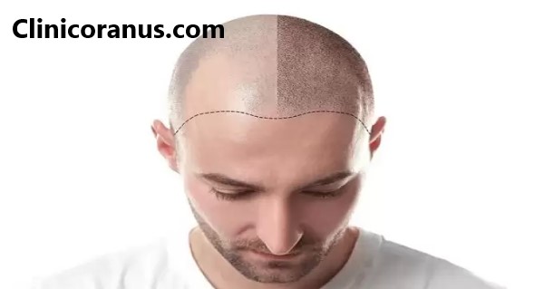 دکتر کاشت موی خوب در جنت آباد - کلینیک اورانوس