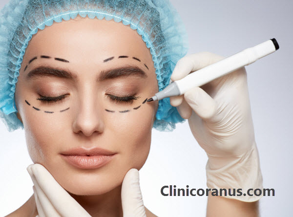 بهترین دکتر عمل پلک در تهران - کلینیک اورانوس