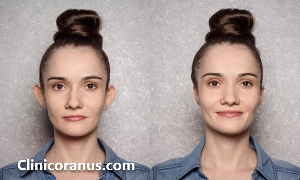 بهترین کلینیک جراحی زیبایی گوش در غرب تهران - کلینیک اورانوس