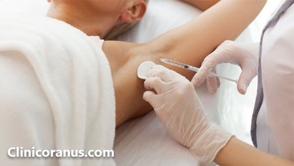 بهترین کلینیک رفع تعریق زیر بغل در غرب تهران - کلینیک اورانوس