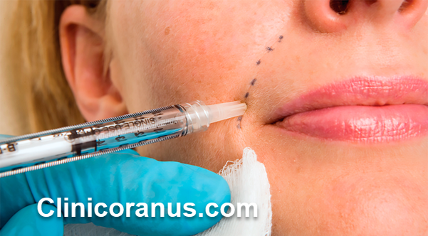 کلینیک انجام فیلر الانسه در غرب تهران | کلینیک اورانوس