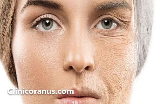 برای رفع چین و چروک صورت چکار کنیم؟ - کلینیک اورانوس