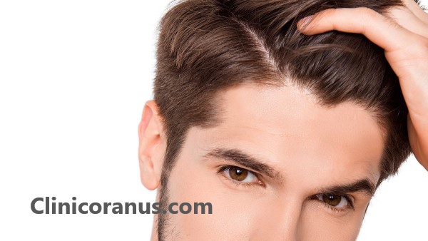 بهترین دکتر کاشت مو در غرب تهران - کلینیک اورانوس