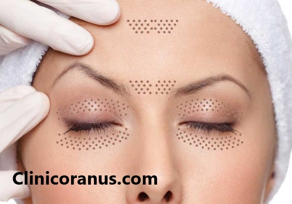 پلاسماجت چیست؟ | کلینیک اورانوس