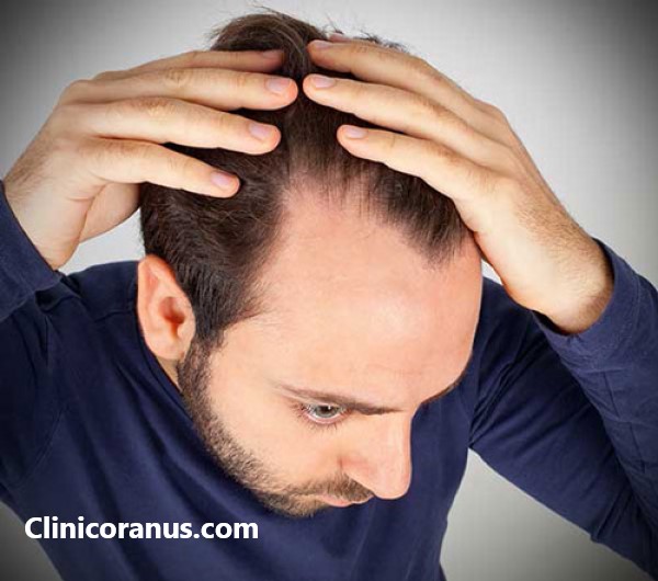 بهترین مرکز کاشت مو در غرب تهران | کلینیک اورانوس