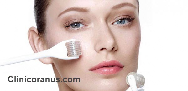 بهترین کلینیک میکرونیدلینگ در جنت آباد - کلینیک اورانوس