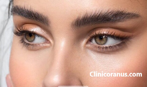 دکتر خوب برای کاشت ابرو در غرب تهران | کلینیک اورانوس