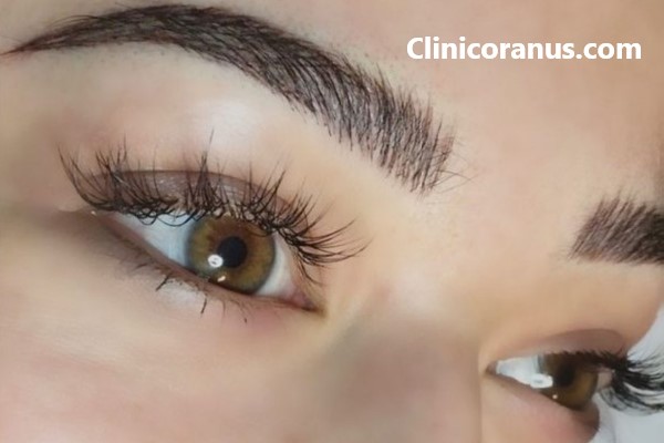 قیمت کاشت ابرو در غرب تهران چقدر است؟ | کلینیک اورانوس