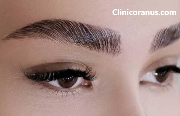 قیمت کاشت ابرو در غرب تهران چقدر است؟ | کلینیک اورانوس