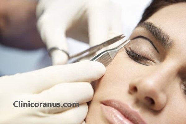 هزینه عمل پلک چشم چقدر است؟ | کلینیک اورانوس
