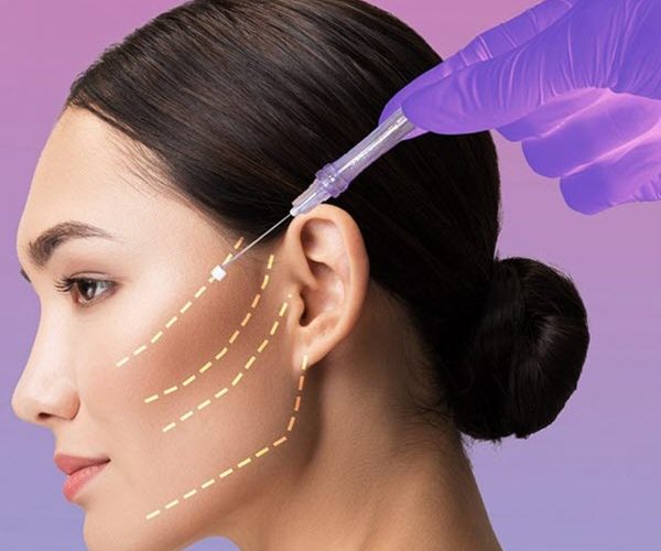 بهترین کلینیک لیفت صورت با نخ در جنت آباد - کلینیک اورانوس