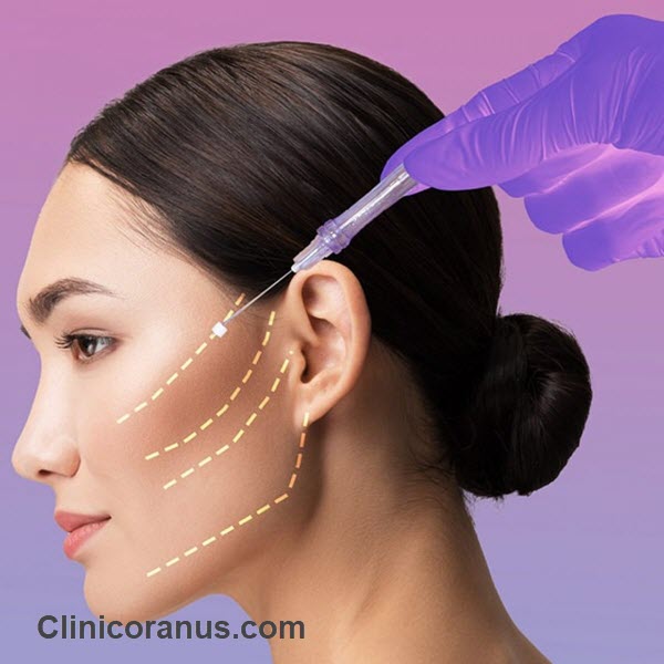 بهترین کلینیک لیفت صورت با نخ در جنت آباد - کلینیک اورانوس