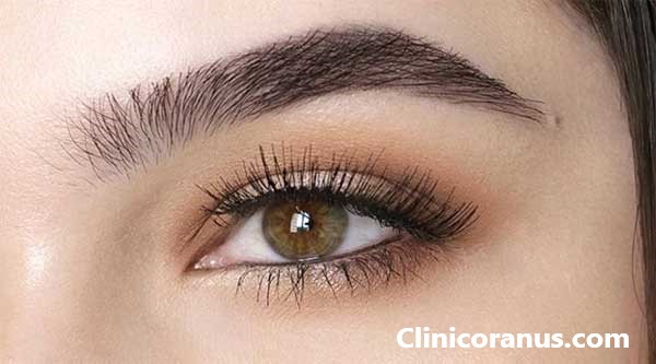 قیمت کاشت ابرو در غرب تهران چقدر است؟ | کلینیک اورانوس