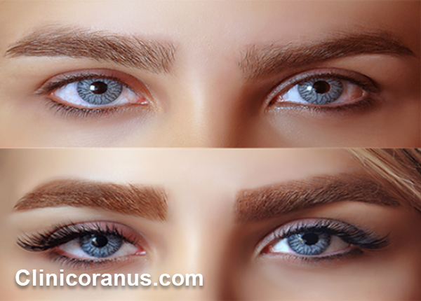 قیمت کاشت ابرو چقدر است؟ - کلینیک اورانوس