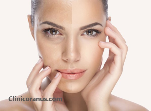 بهترین کلینیک جوانسازی صورت در غرب تهران | کلینیک اورانوس