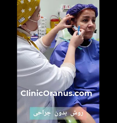 لیفت-با-نخ-clinicoranus.com لیفت با نخ در غرب تهران | کلینیک اورانوس