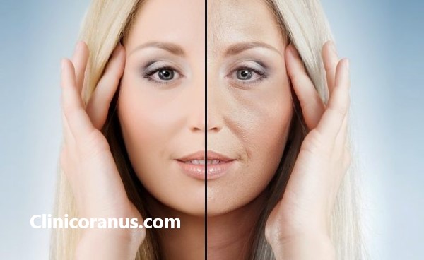 بهترین کلینیک جوانسازی صورت در غرب تهران | کلینیک اورانوس