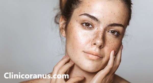 بهترین روش از بین بردن لک های پوستی - کلینیک اورانوس