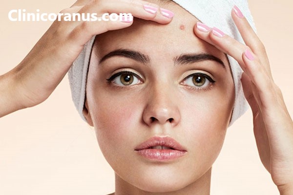 بهترین روش از بین بردن لک های پوستی - کلینیک اورانوس