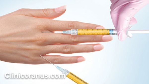 مرکز تزریق چربی به روش نانوفت در جنت آباد - کلینیک اورانوس