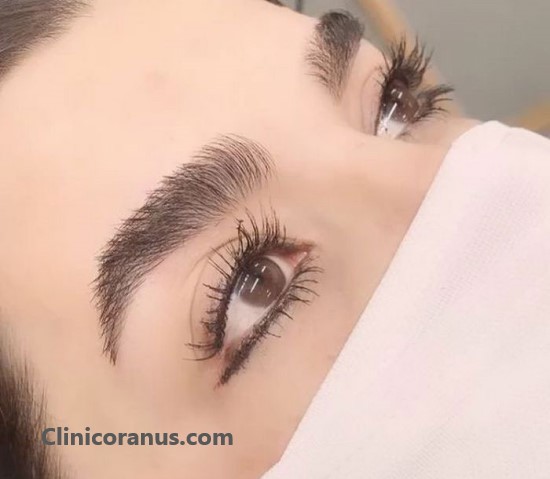 بهترین دکتر کاشت ابرو در غرب تهران | کلینیک اورانوس