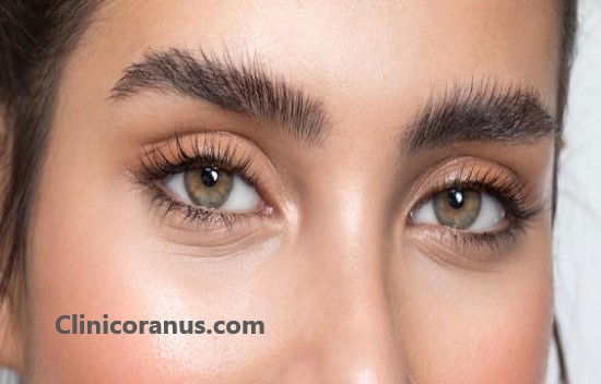 بهترین دکتر کاشت ابرو در غرب تهران | کلینیک اورانوس