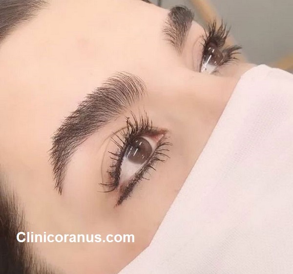 دکتر خوب برای کاشت ابرو در جنت آباد | کلینیک اورانوس