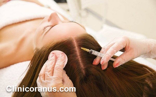 هزینه هر جلسه مزوتراپی مو سال 1401 - کلینیک اورانوس