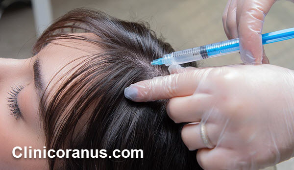 هزینه هر جلسه مزوتراپی مو سال 1401 - کلینیک اورانوس