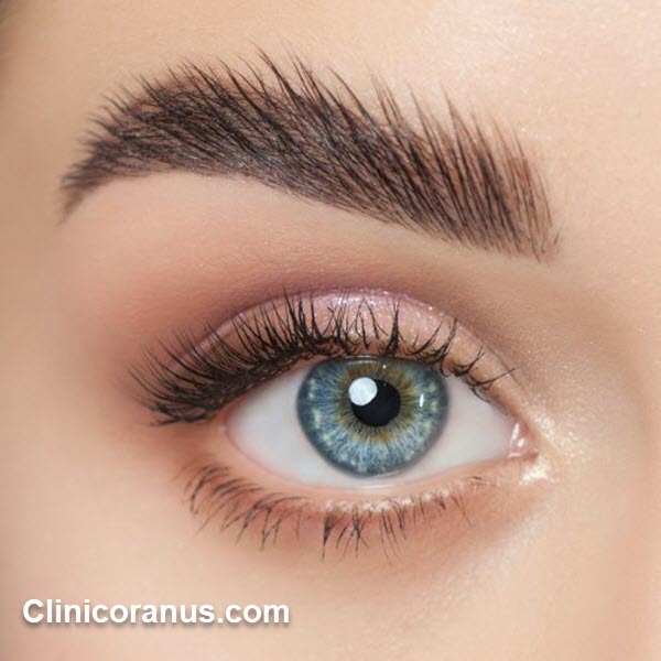 هزینه کاشت ابرو طبیعی در سال 1401 - کلینیک اورانوس