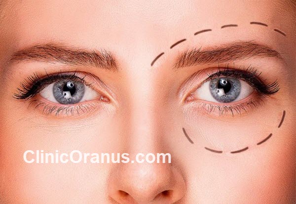 بهترین دکتر جراح بفلاروپلاستی در غرب تهران | کلینیک اورانوس