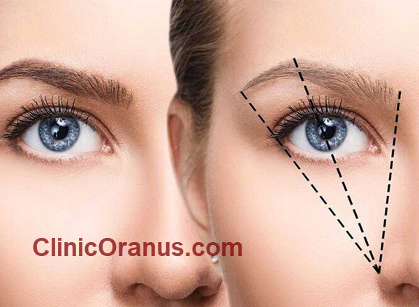 ویژگیهای بهترین کلینیک کاشت ابرو در تهران