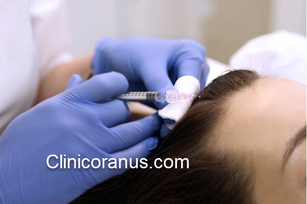 تعداد جلسات مزوتراپی مو چقدر است؟ | کلینیک اورانوس